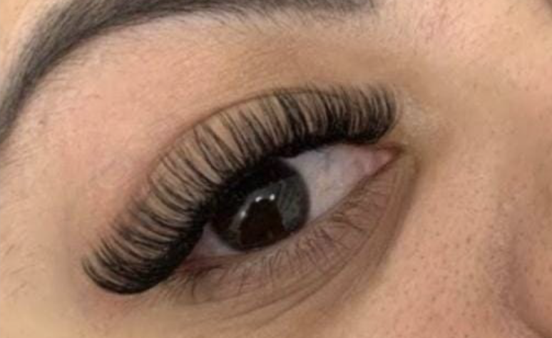 Alongamento v. Russo